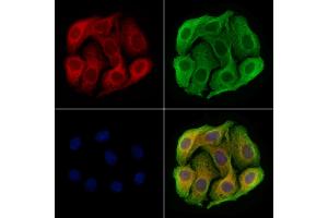 ABIN7094489 and ABIN7098538 staining Hela cells by IF/ICC.