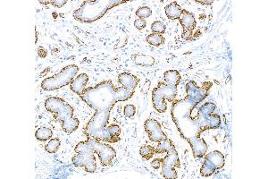 Immunohistochemistry (IHC) image for anti-Actin, alpha 2, Smooth Muscle, Aorta (ACTA2) (AA 1-50) antibody (ABIN7449438)