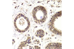 Immunohistochemistry of paraffin-embedded human mammary gland using HDAC5 antibody. (HDAC5 抗体)