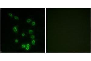 Immunofluorescence analysis of HepG2 cells, using DARPP-32 (Phospho-Thr34) Antibody.