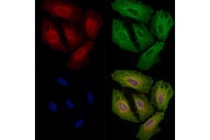 ABIN6257331 and ABIN6275242 staining  cells by IF/ICC. (MRPL3 抗体  (N-Term))