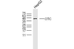 Human HepG2 cells probed with OTC Polyclonal Antibody, unconjugated  at 1:300 overnight at 4°C followed by a conjugated secondary antibody at 1:10000 for 90 minutes at 37°C. (OTC 抗体  (AA 51-150))