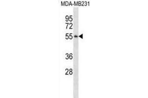 Western Blotting (WB) image for anti-Pepsinogen 3, Group I (Pepsinogen A) (PGA3) antibody (ABIN2995164) (PGA3 抗体)