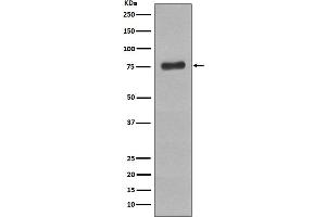 Western blot analysis of Phospho-BTK (Y223) expression in Raji cell lysate treated with pervanadate.