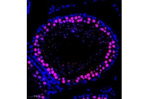 Immunofluorescence of paraffin embedded rat testis using SCP1 (ABIN7075786) at dilution of 1:500 (300x lens) (SYCP1 抗体)