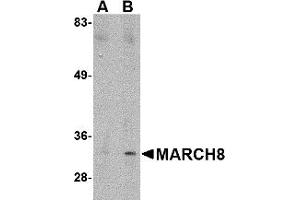Western Blotting (WB) image for anti-Membrane-Associated Ring Finger (C3HC4) 8, E3 Ubiquitin Protein Ligase (MARCH8) (C-Term) antibody (ABIN1030506) (MARCH8 抗体  (C-Term))