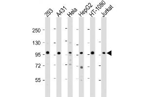 Western Blot at 1:2000 dilution Lane 1: 293 whole cell lysate Lane 2: A431 whole cell lysate Lane 3: Hela whole cell lysate Lane 4: HepG2 whole cell lysate Lane 5: HT-1080 whole cell lysate Lane 6: Jurkat whole cell lysate Lysates/proteins at 20 ug per lane. (DDX21 抗体  (N-Term))