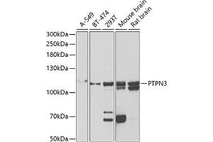 Western blot analysis of extracts of various cell lines, using PTPN3 antibody (ABIN6132535, ABIN6146448, ABIN6146449 and ABIN6222030) at 1:1000 dilution. (PTPN3 抗体  (AA 1-300))