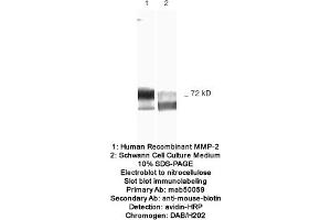 Image no. 1 for anti-Matrix Metalloproteinase 2 (MMP2) antibody (ABIN363213) (MMP2 抗体)
