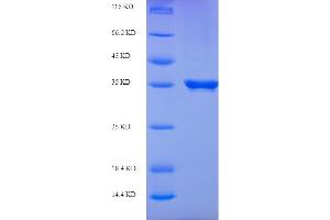 SDS-PAGE (SDS) image for Cytosolic Thiouridylase Subunit 2 (CTU2) (AA 20-196) protein (His-SUMO Tag) (ABIN5711143)