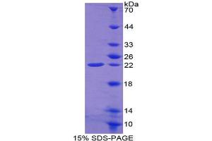 SDS-PAGE (SDS) image for Ferritin, Heavy Polypeptide 1 (FTH1) (AA 1-182) protein (His tag) (ABIN1079498) (FTH1 Protein (AA 1-182) (His tag))