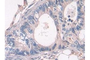 Immunohistochemistry (IHC) image for anti-Proteasome (Prosome, Macropain) 26S Subunit, Non-ATPase, 2 (PSMD2) (AA 645-872) antibody (ABIN7439738)