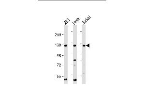 All lanes : Anti-INTS3 Antibody (C-Term) at 1:2000 dilution Lane 1: 293 whole cell lysate Lane 2: Hela whole cell lysate Lane 3: Jurkat whole cell lysate Lysates/proteins at 20 μg per lane. (INTS3 抗体  (AA 1000-1034))