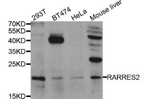 Western blot analysis of extracts of various cell lines, using RARRES2 antibody. (Chemerin 抗体)