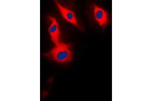 Immunofluorescent analysis of ACRBP staining in HeLa cells. (ACRBP 抗体  (Center))