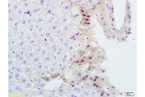 Immunohistochemistry (Paraffin-embedded Sections) (IHC (p)) image for anti-Tumor Necrosis Factor (Ligand) Superfamily, Member 14 (TNFSF14) (AA 141-240) antibody (ABIN740625)