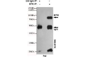 Immunoprecipitation analysis of Raji cell lysates using BTK mouse mAb. (BTK 抗体)