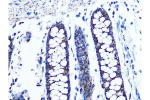 Immunohistochemistry of paraffin-embedded human colon using UQCRC2 Rabbit mAb (ABIN1679334, ABIN3018863, ABIN3018864 and ABIN7101676) at dilution of 1:100 (40x lens). (UQCRC2 抗体)