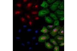 Phospho-Rab8 (Thr72) Antibody staining A549 cells(4h of LPS treatment) by IF/ICC. (RAB8A 抗体  (pThr72))