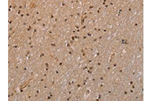 The image is immunohistochemistry of paraffin-embedded Human brain tissue using ABIN7129566(GADD45A Antibody) at dilution 1/30. (GADD45A 抗体)