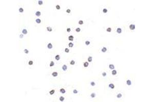 Immunocytochemistry of TLR6 in Jurkat cells with this product at 2 μg/ml. (TLR6 抗体  (Center))