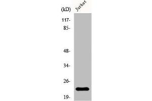 Western Blot analysis of Jurkat cells using D54 Polyclonal Antibody (TPD52L2 抗体  (C-Term))