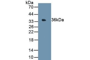 Detection of Recombinant MT1E, Human using Monoclonal Antibody to Metallothionein 1E (MT1E) (MT1E 抗体  (AA 1-61))