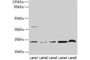 Western blot All lanes: CRYBA1 antibody at 6 μg/mL Lane 1: Human placenta tissue Lane 2: U251 whole cell lysate Lane 3: U937 whole cell lysate Lane 4: Mouse stomach tissue Lane 5: Mouse liver tissue Secondary Goat polyclonal to rabbit IgG at 1/10000 dilution Predicted band size: 26, 24 kDa Observed band size: 24 kDa (CRYBA1 抗体  (AA 1-215))