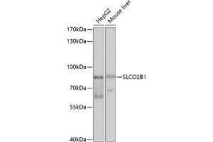 Western blot analysis of extracts of various cell lines, using SLCO2B1 antibody (ABIN6130909, ABIN6148066, ABIN6148067 and ABIN6214197) at 1:1000 dilution. (SLCO2B1 抗体  (AA 130-210))