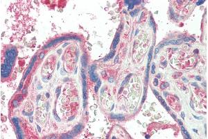 ABIN570663 (5µg/ml) staining of paraffin embedded Human Plcenta. (TXK 抗体  (C-Term))