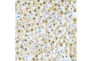Immunohistochemistry of paraffin-embedded rat liver using PIBF1 Antibody. (PIBF1 抗体)