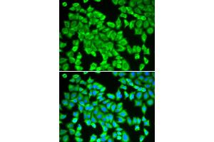 Immunofluorescence analysis of HeLa cells using STIP1 antibody (ABIN5970561). (STIP1 抗体)