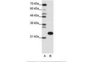 Image no. 1 for anti-Ribosomal Protein L13 (RPL13) (C-Term) antibody (ABIN6736166) (RPL13 抗体  (C-Term))