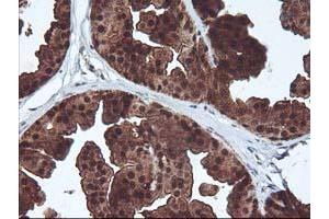 Immunohistochemical staining of paraffin-embedded Human breast tissue using anti-DSTN mouse monoclonal antibody. (Destrin 抗体)