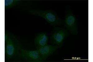 Immunofluorescence of monoclonal antibody to ZEB1 on U-2 OS cell. (ZEB1 抗体  (AA 801-900))