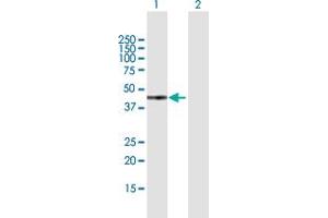 Western Blot analysis of GTF2H2 expression in transfected 293T cell line by GTF2H2 MaxPab polyclonal antibody. (GTF2H2 抗体  (AA 1-395))