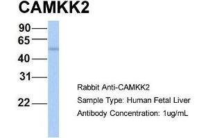 Host: Rabbit  Target Name: CAMKK2  Sample Tissue: Human Fetal Liver  Antibody Dilution: 1. (CAMKK2 抗体  (N-Term))