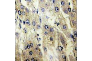 Immunohistochemistry (IHC) image for anti-Solute Carrier Family 27 (Fatty Acid Transporter), Member 5 (SLC27A5) (Center) antibody (ABIN7299592)