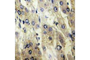 Immunohistochemical analysis of FATP5 staining in human liver formalin fixed paraffin embedded tissue section. (SLC27A5 抗体  (Center))