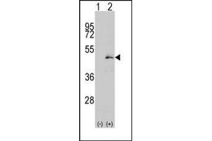 Image no. 1 for anti-Mitogen-Activated Protein Kinase Kinase 1 (MAP2K1) (Ser216) antibody (ABIN360367) (MEK1 抗体  (Ser216))