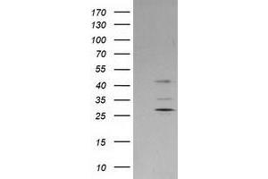 Western Blotting (WB) image for anti-Plasminogen Activator Inhibitor 2 (SERPINB2) antibody (ABIN1500885) (SERPINB2 抗体)