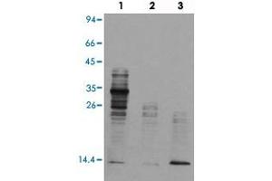 Western blot analysis of Lane 1: mouse brain tissue lysates, Lane 2: Hela cell lysates, Lane 3: TSA treated Hela cell lysates reacted with Acetyl lysine monoclonal antibody  at 1:1000-1:2000 dilution. (Acetylated Lysine 抗体  (acetylated))
