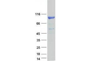 Validation with Western Blot