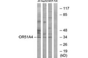Western Blotting (WB) image for anti-Olfactory Receptor, Family 51, Subfamily A, Member 4 (OR51A4) (AA 200-249) antibody (ABIN2891139) (OR51A4 抗体  (AA 200-249))