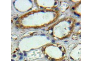 Used in DAB staining on fromalin fixed paraffin-embedded Kidney tissue (CA12 抗体  (AA 25-302))