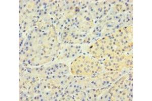 Immunohistochemistry of paraffin-embedded human pancreatic tissue using ABIN7170187 at dilution of 1:100 (SLC25A35 抗体  (AA 120-168))