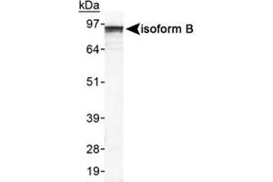Western blot analysis of EPB41L3 in HeLa whole cell lysate using EPB41L3 polyclonal antibody . (EPB41L3 抗体  (AA 400-500))