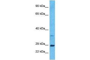 Host:  Rabbit  Target Name:  BDNF  Sample Type:  ACHN Whole Cell lysates  Antibody Dilution:  1ug/ml (BDNF 抗体  (Middle Region))