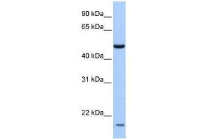 Human Lung; WB Suggested Anti-ZNF764 Antibody Titration: 0. (ZNF764 抗体)