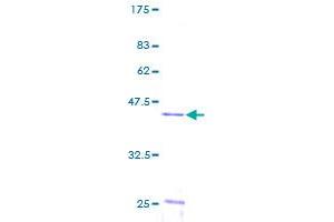 Ubiquitin-Conjugating Enzyme E2N (UBE2N) (AA 1-152) protein (GST tag)
